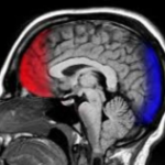 Podredumbre cerebral: el uso excesivo del internet reduce la materia gris